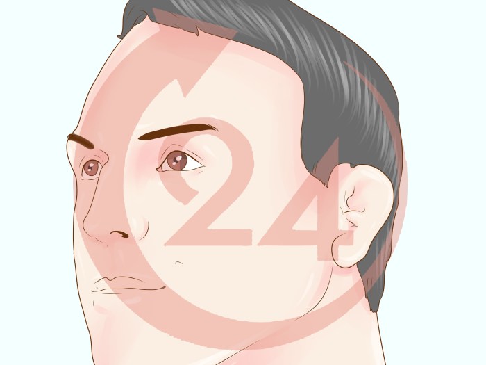 Cauliflower ear preventing bjjee ales bryan guest dr post Is cauliflower ear permanent?