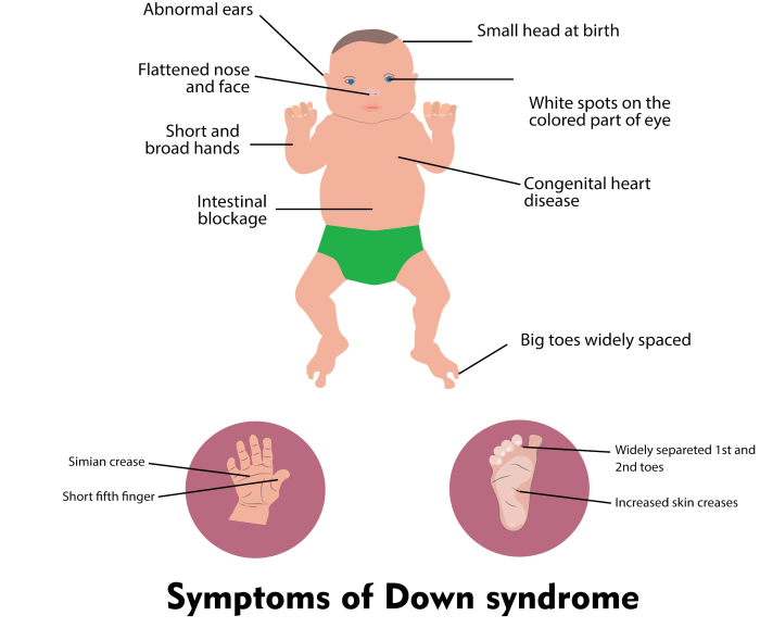 Does rugby have downs