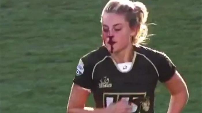 Is it easy to get hurt in rugby?