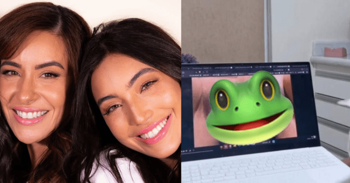 Foto: Antes e depois de Lica Lopes: mãe de Vanessa Lopes envolvida em ... Mae Da Vanessa Lopes Cirurgia Intima