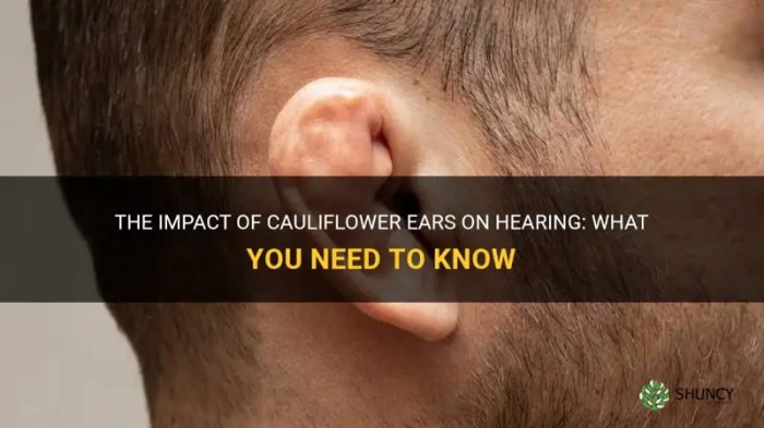 Ear cauliflower Ear cauliflower