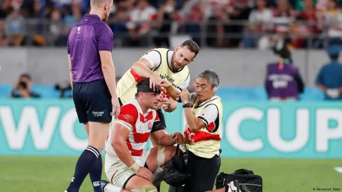How To Make Rugby Safer – FluentRugby How To Make Rugby Safer – FluentRugby