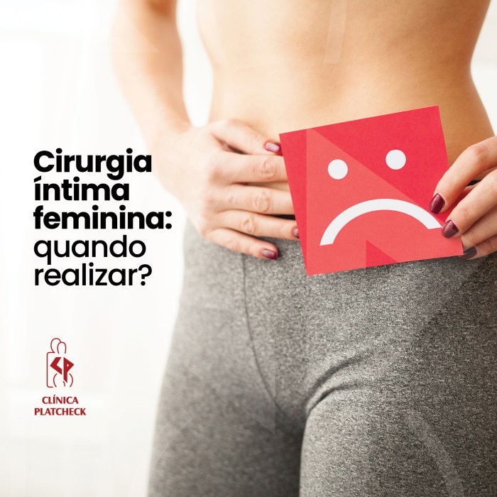 Cirurgia íntima: quando realizar? – Clínica Platcheck Lica Lopes Cirurgia Intima Fotos