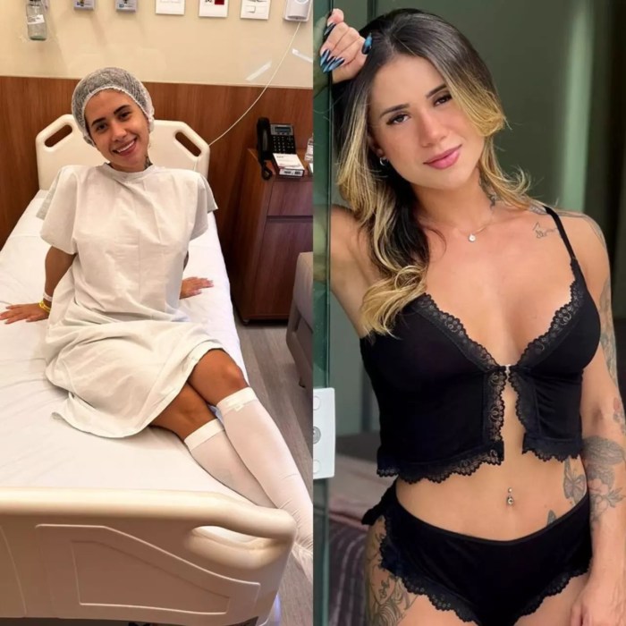 Atual Miss Bumbum, Larissa Sumpani faz cirurgia de ninfoplastia – Vírgula Atual Miss Bumbum, Larissa Sumpani faz cirurgia de ninfoplastia – Vírgula