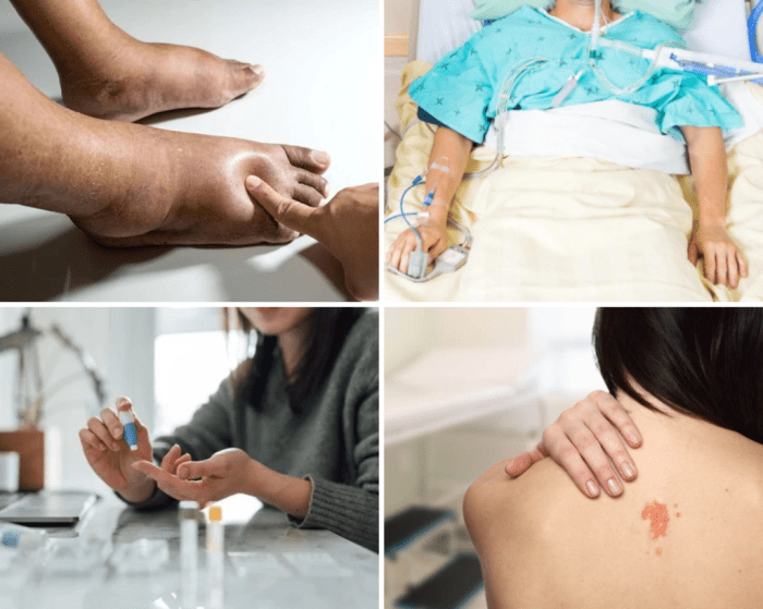 Diabetes tem cura? Terapias e estilo de vida poderosos - Todo Dia Mais Leve Cura Para Diabetes