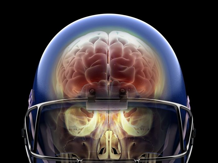 What sport has the most traumatic brain injuries?
