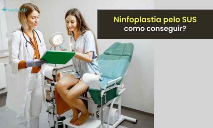 Ninfoplastia pelo SUS: Em que casos é possível fazer procedimento na ... Ninfoplastia pelo SUS: Em que casos é possível fazer procedimento na ...