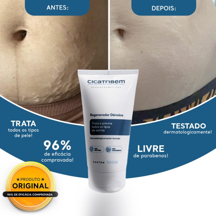 Creme para Estrias Cicatribem 150g - Trata Todos os Tipos de Estrias ... Creme para Estrias Cicatribem 150g - Trata Todos os Tipos de Estrias ...