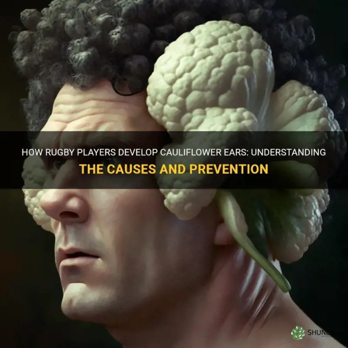 Why do rugby players get cauliflower ears?