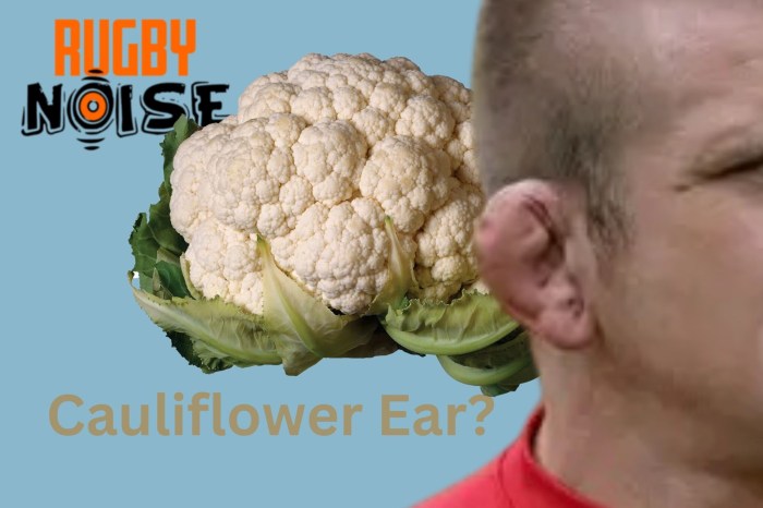 Rugby ears cauliflower players why get official site bath please club go click not here Rugby ears cauliflower players why get official site bath please club go click not here