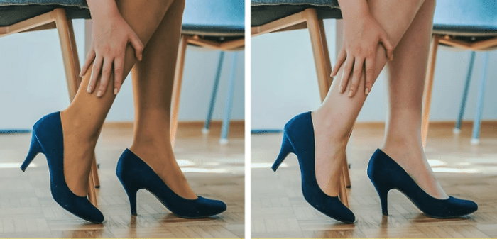 7 tipos de meia calça: Como escolher? Meia Calça Cor Da Pele
