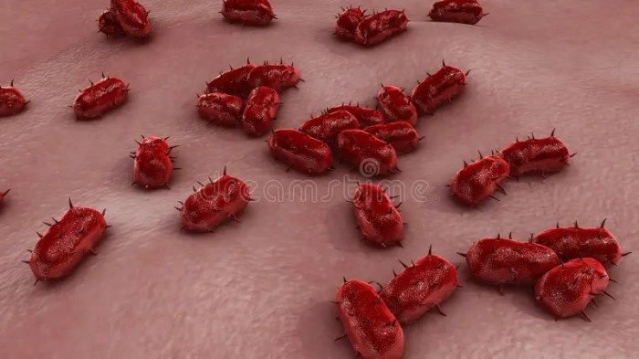 Meningite bacteriana imagem de stock. Imagem de bactérias - 84219853 Meningite bacteriana imagem de stock. Imagem de bactérias - 84219853