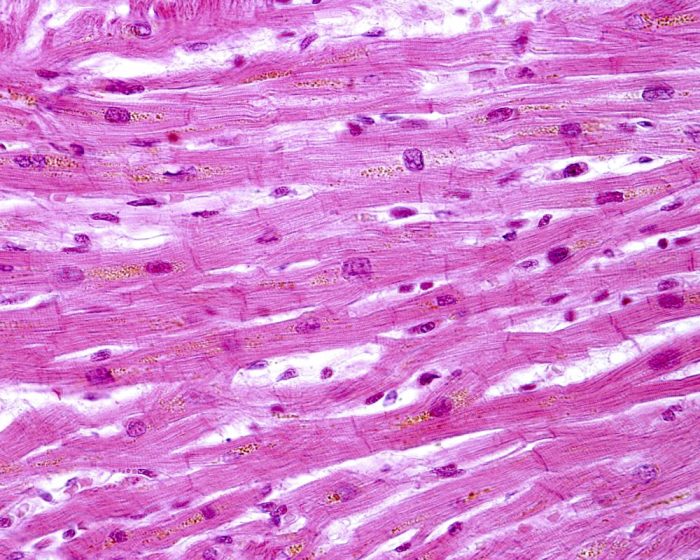 Tipos de músculos - liso, estriado e cardíaco - Biologia - InfoEscola Podemos Considerar Sobre O Músculo Estriado Cardíaco