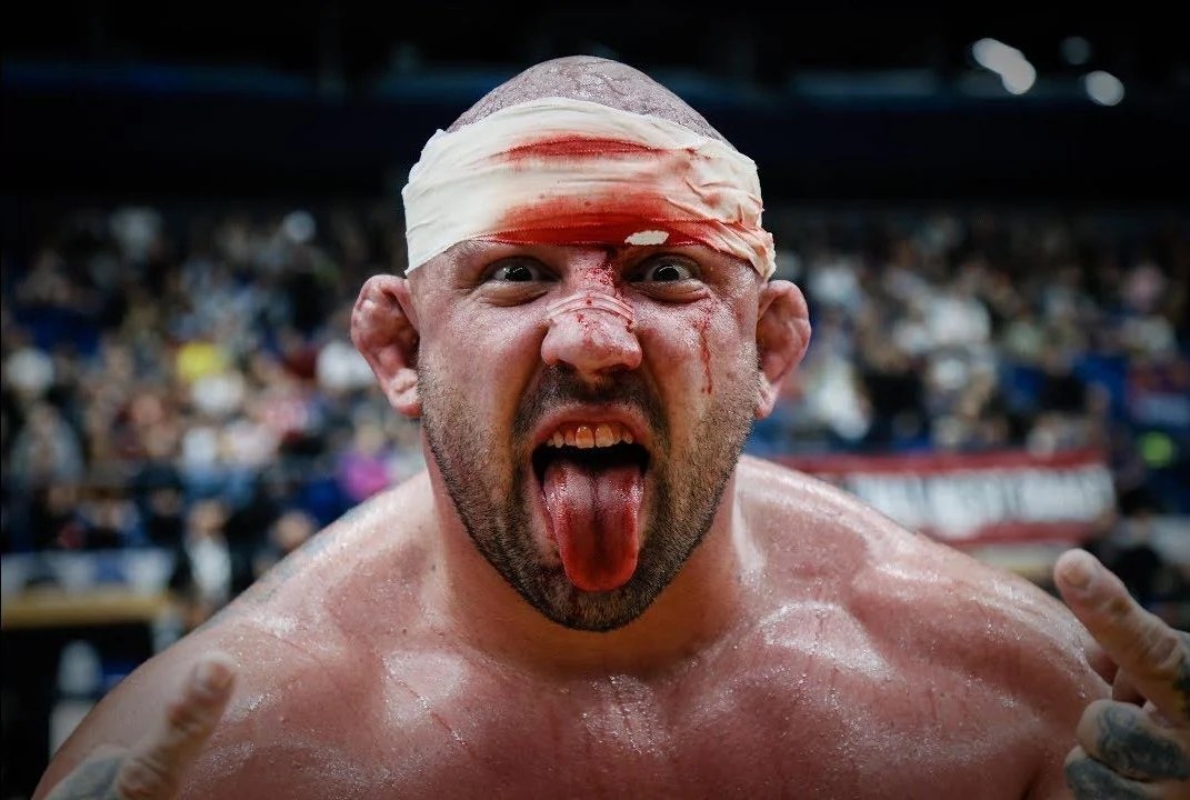 How do humans get cauliflower ear?