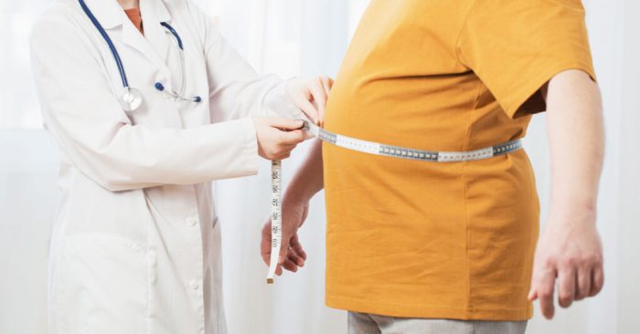 Cirurgia Sleeve E Bypass Gástrico: Qual A Diferença? Sleeve Cirurgia