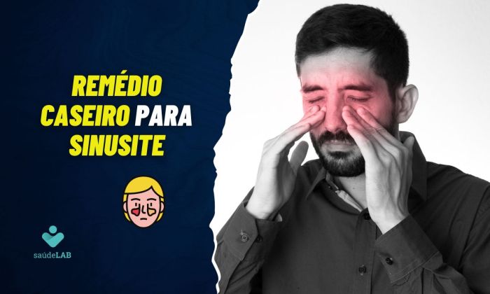 Remédio caseiro para sinusite: confira 10 opções naturais para aliviar ... Melhores Remedios Para Sinusite
