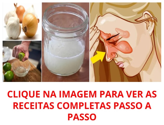 3 Remédios Caseiros Para Sinusite! MELHORES RECEITAS! – Incríveis Dicas ... Melhores Remedios Para Sinusite