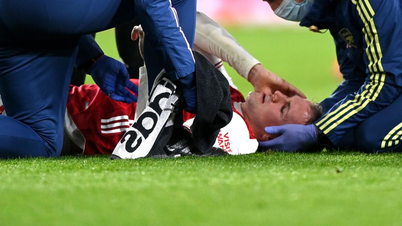 Concussions athletes traumatic concussion godanriver struggles academy