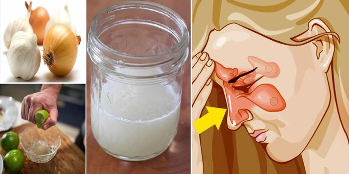 3 Remédios Caseiros Para Sinusite! MELHORES RECEITAS! – Dicas de Saúde ... 3 Remédios Caseiros Para Sinusite! MELHORES RECEITAS! – Dicas de Saúde ...
