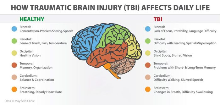 What sport has the most traumatic brain injuries?