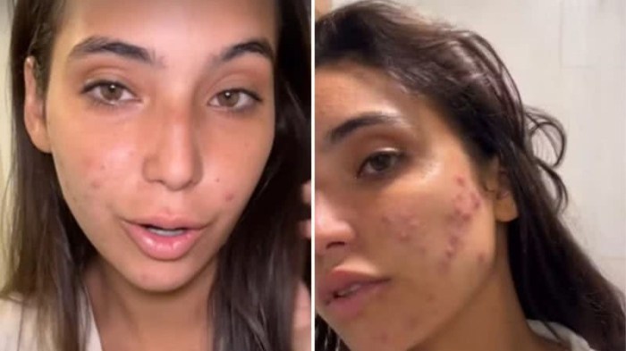 Vanessa Lopes desabafa após realizar quatro cirurgias: 'Muito medo ... Foto Do Resultado Da Cirurgia Da Mae Da Vanessa Lopes