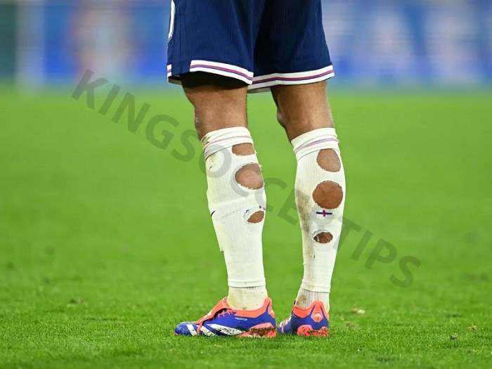 Do rugby players cut their socks?