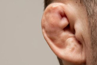 Does cauliflower ear affect hearing?