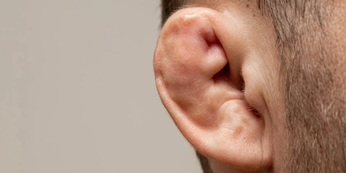 Does cauliflower ear affect hearing?