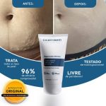Creme para Estrias Cicatribem 150g - Trata Todos os Tipos de Estrias ...