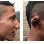 How do humans get cauliflower ear?