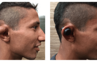How do humans get cauliflower ear?