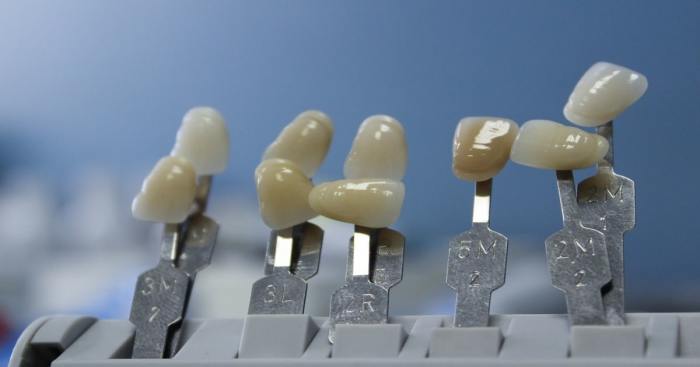 Dente Falso Provisório
